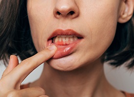 Woman with a missing tooth