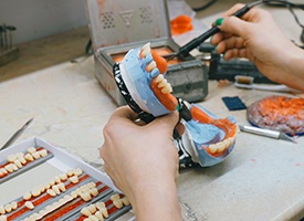 The denture creation process is a fascinating journey