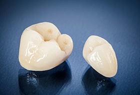 A closeup of metal-free ceramic dental crowns